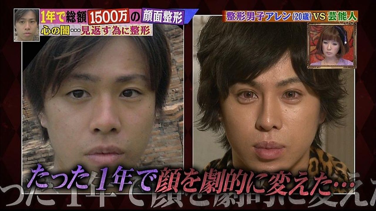 画像 1500万円出して整形したこの男の顔どうなの レッツ芸能ニュースまとめブログ 画像 1500万円出して整形したこの男の顔どうなの レッツ芸能ニュースまとめブログ