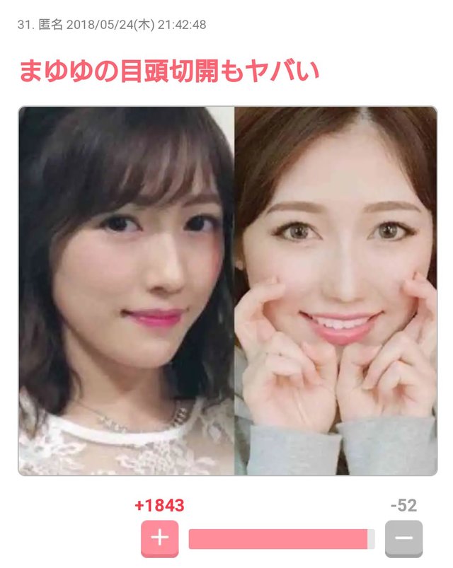 悲報 渡辺麻友が整形 顔が変わりすぎて大炎上 まゆゆ レッツ芸能ニュースまとめブログ 悲報 渡辺麻友が整形 顔が変わりすぎて大炎上 まゆゆ レッツ芸能ニュースまとめブログ