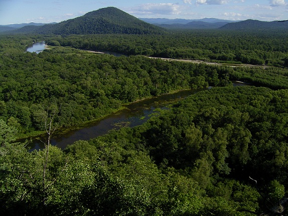 水頭症の息子の命を救うための夫婦の必死の努力