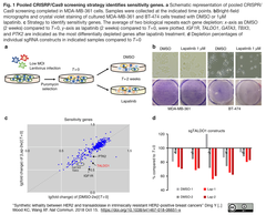 HER2阻害に自然耐性を示す乳癌をトランスアルドラーゼ阻害で合成致死へ