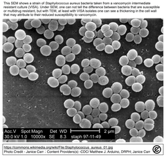 CRISPR-Cas9 GEをリポプレックスで送達することでメチシリン耐性黄色ブドウ球菌（MRSA）のエリスロマイシンに対する再感受性化を実現しました