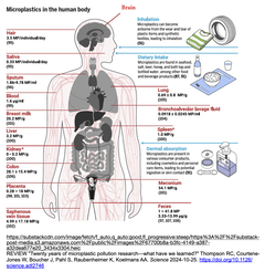 [20250313更新] 微細なプラスチックの破片がヒトの脳, 特に認知症患者の脳に, 蓄積されている