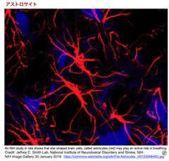 神経炎症と脳腫瘍の調節因子としてのアストロサイト