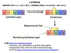 上皮間葉転換（EMT）は癌転移の主役なのか？