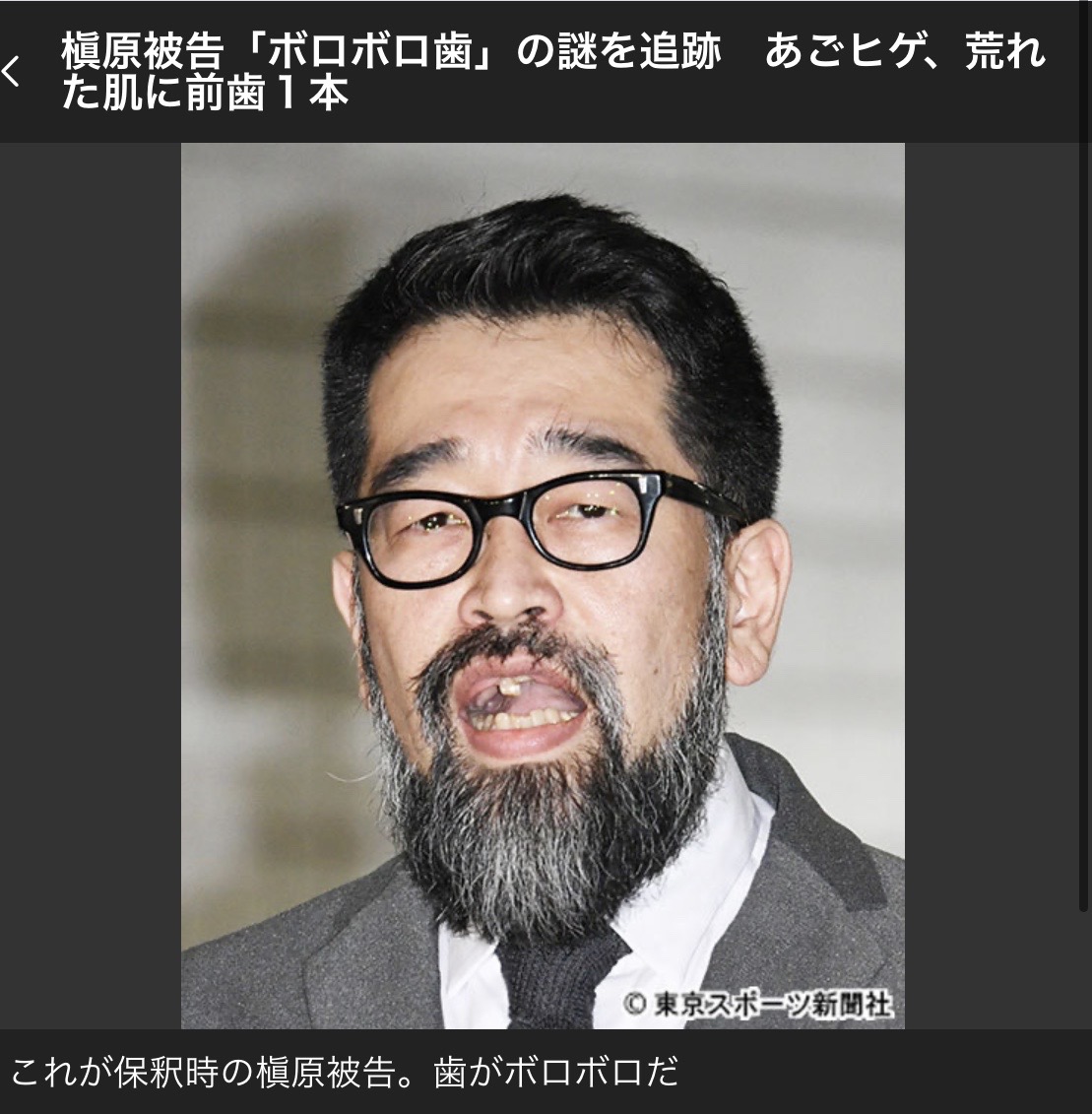 画像 薬中の槇原敬之さん 前歯が１本しか無かったｗｗｗｗ 気になる芸能まとめ