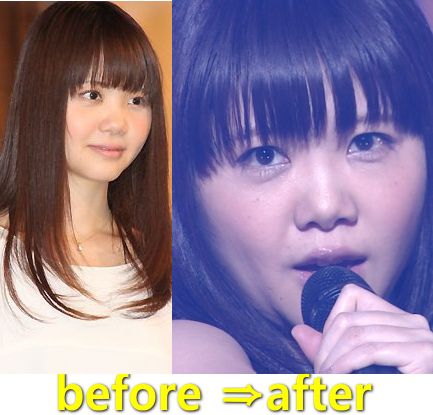 歌手 いきものがかり 吉岡聖恵 復帰後のフェイスライン に驚きの声 気になる芸能まとめ 歌手 いきものがかり 吉岡聖恵 復帰後のフェイスライン に驚きの声 気になる芸能まとめ