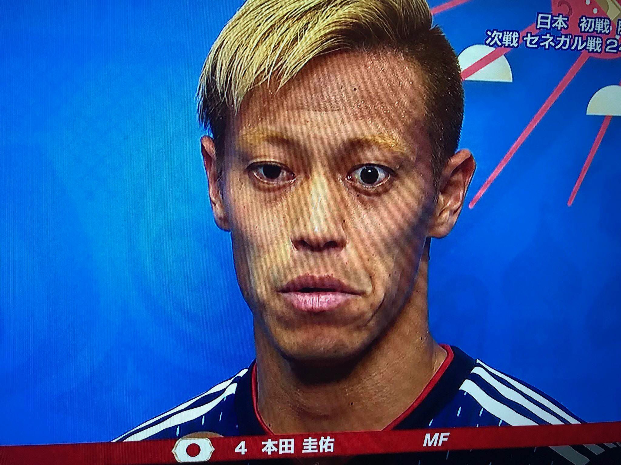 悲報 本田圭佑さん 怪我で別メニュー調整 気になる芸能まとめ 悲報 本田圭佑さん 怪我で別メニュー調整 気になる芸能まとめ