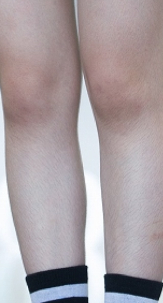 画像 芦田愛菜さん 腕毛とスネ毛が凄い 気になる芸能まとめ