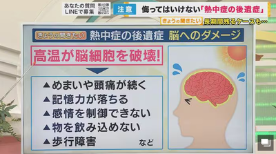 2024y08m02d_093125275