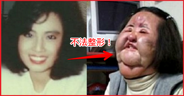 不法整形手術で話題になった 扇風機おばさん 享年57歳で死去 Popoblog