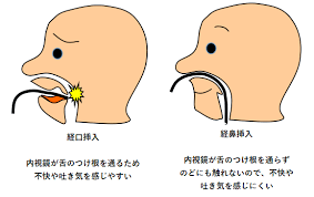 エントリ画像
