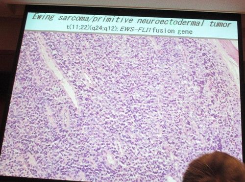 ��������39