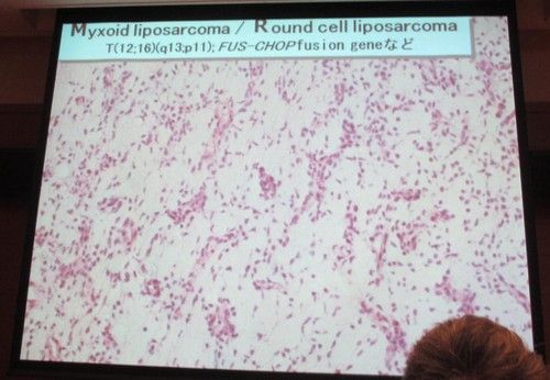 ��������41