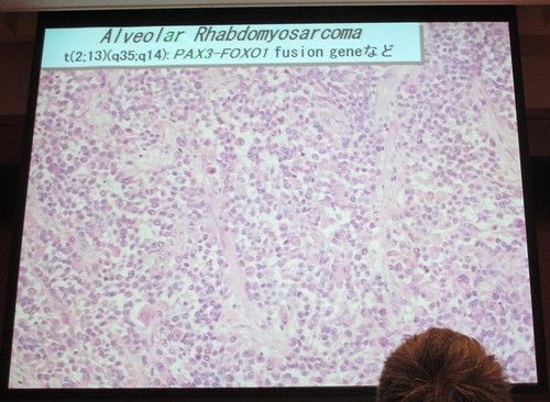 ��������38