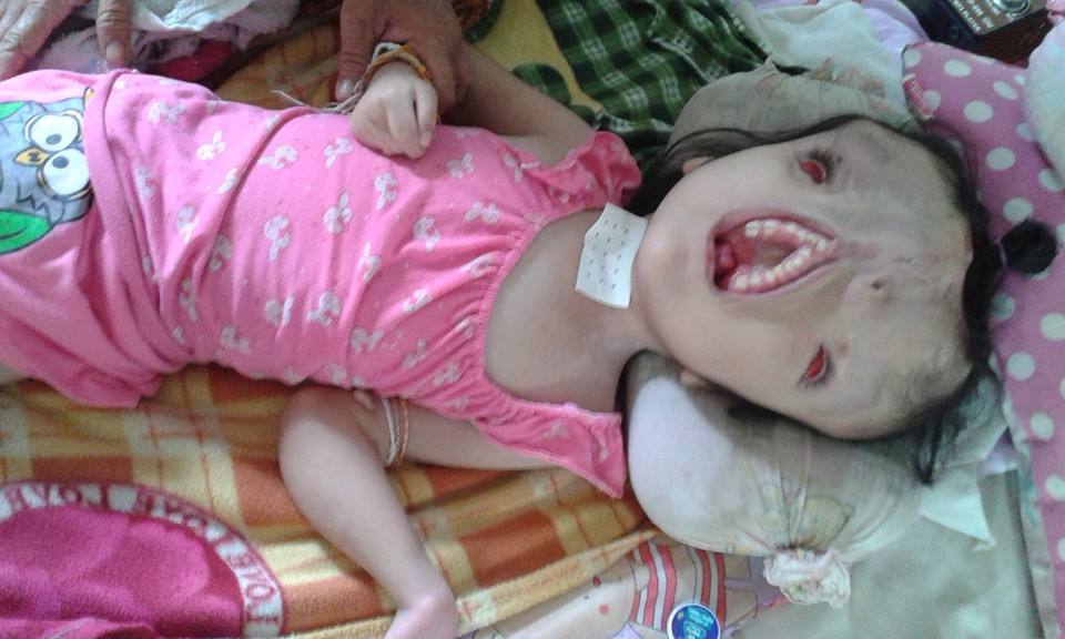 画像 障害児を無理やり育てた結果ｗｗｗｗｗｗｗｗｗｗｗｗｗｗｗｗｗ ちょｗｗｗ勢いｗｗｗ