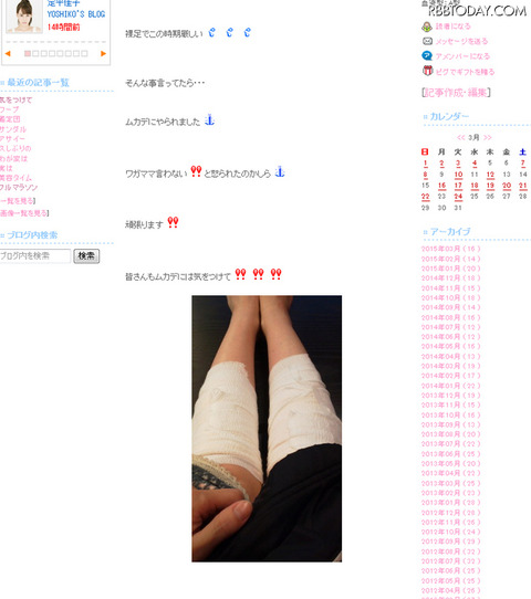 【ムカデ人間ｗｗｗ】雛形あきこ、時代劇の撮影中にムカデに噛まれる……包帯巻いた両脚の写真公開