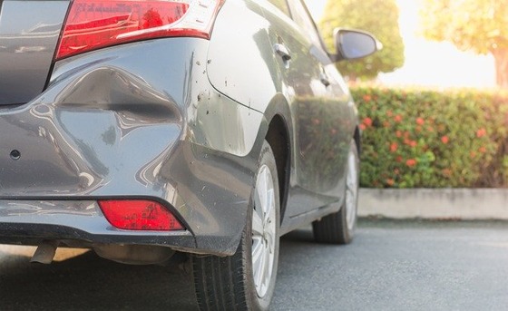 Best-Dent-Repair-Kit-for-Cars