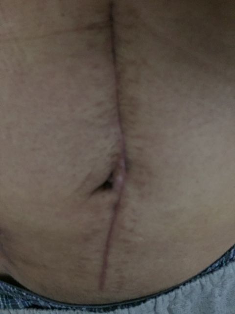 大腸