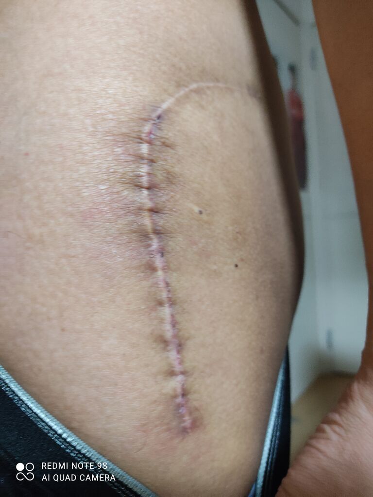 白血病から復活した男のブログじゃ 白血病から復活した男のブログじゃ