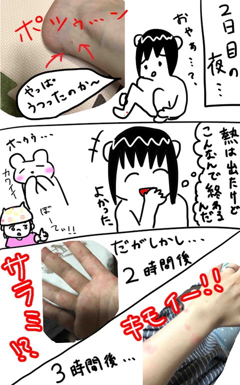 手足口病3