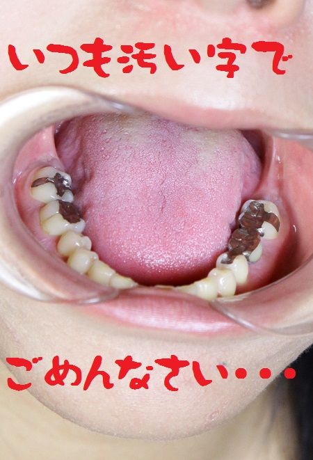 ごめんなさい