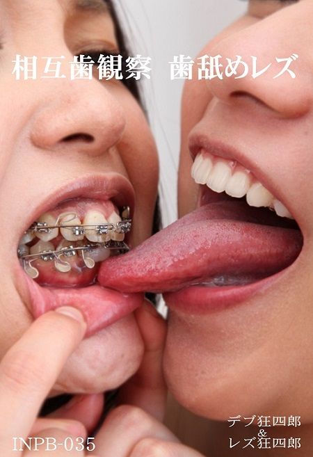 INPB_035歯観パケA