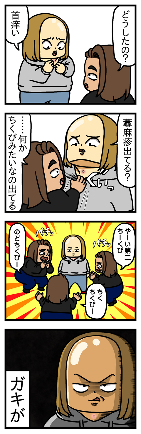 のどちくび