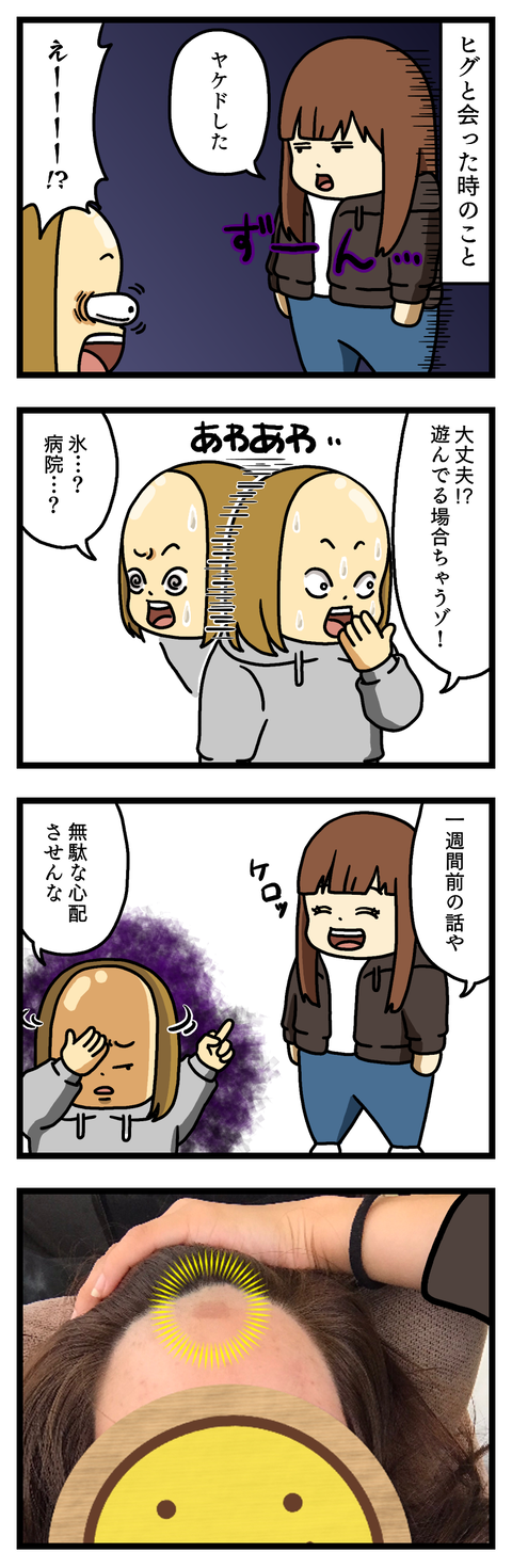 ヒグ、やらかす④