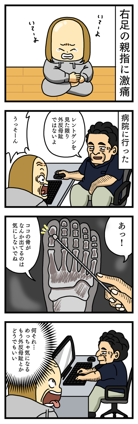 出しゃばりな骨