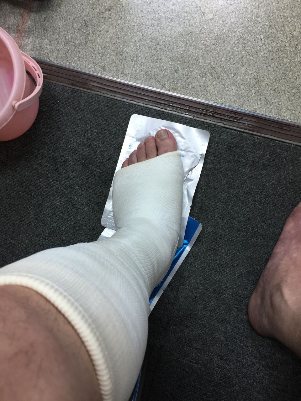 Dennis 50 15 03 19 木 雨 ギプス装着中 これから3週間左足首をギプスで固定します Dennis 50 15 03 19 木 雨 ギプス装着中 これから3週間左足首をギプスで固定します