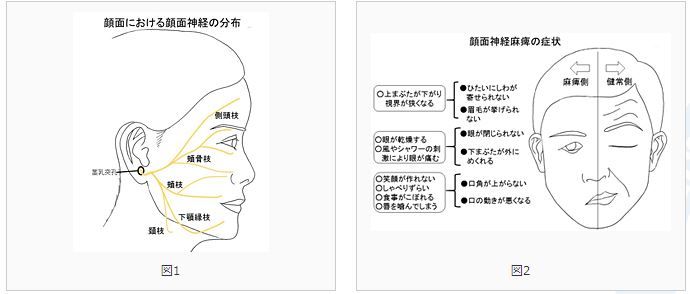神経麻痺と症状の組み合わせ わかる 1聞いて5言えるか 神経麻痺と症状の組み合わせ わかる 1聞いて5言えるか