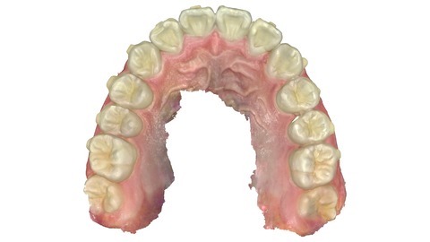 gallery_penta_upper_m