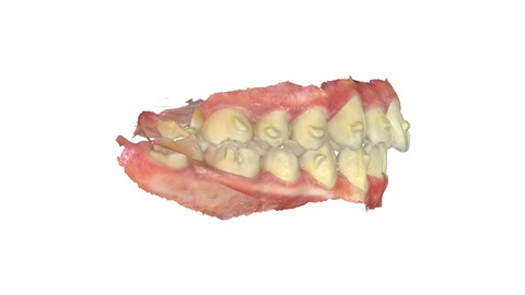 gallery_penta_left_m