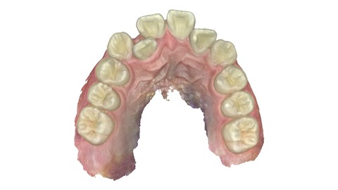 gallery_penta_upper_m