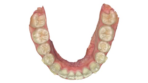 gallery_penta_lower_m