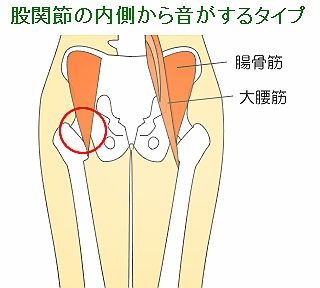 バレリーナに多い股関節の痛み コウシンドウのblog バレリーナに多い股関節の痛み コウシンドウのblog