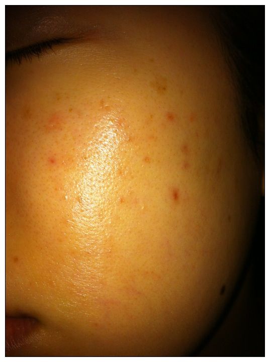 メナード三回目 Boyaki