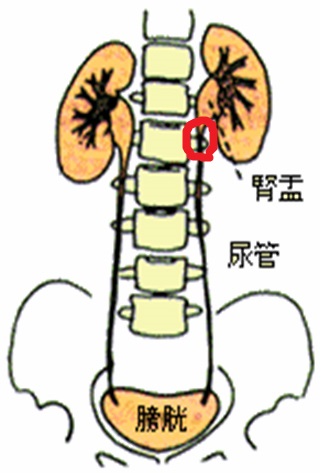 61c5f851