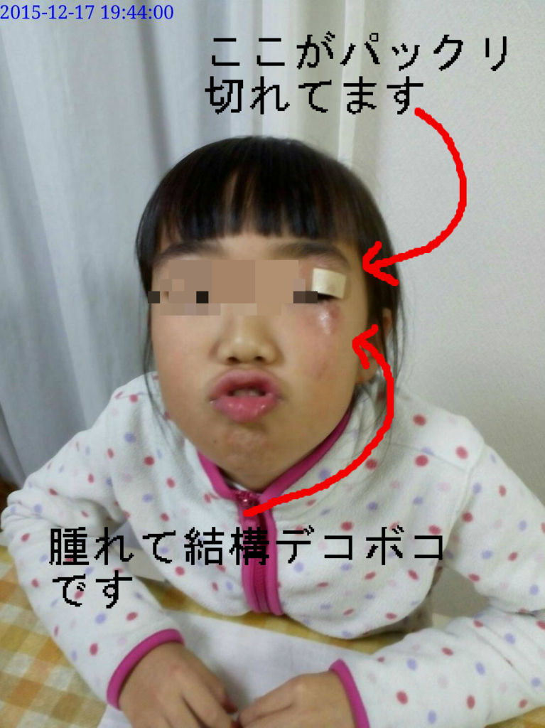 100均グッズで快適に 夏だ 節電だ 冷蔵庫カーテン ダッド パパ のdiy Usedブログ