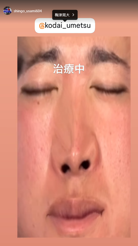 中日・宇佐見真吾「治療中」