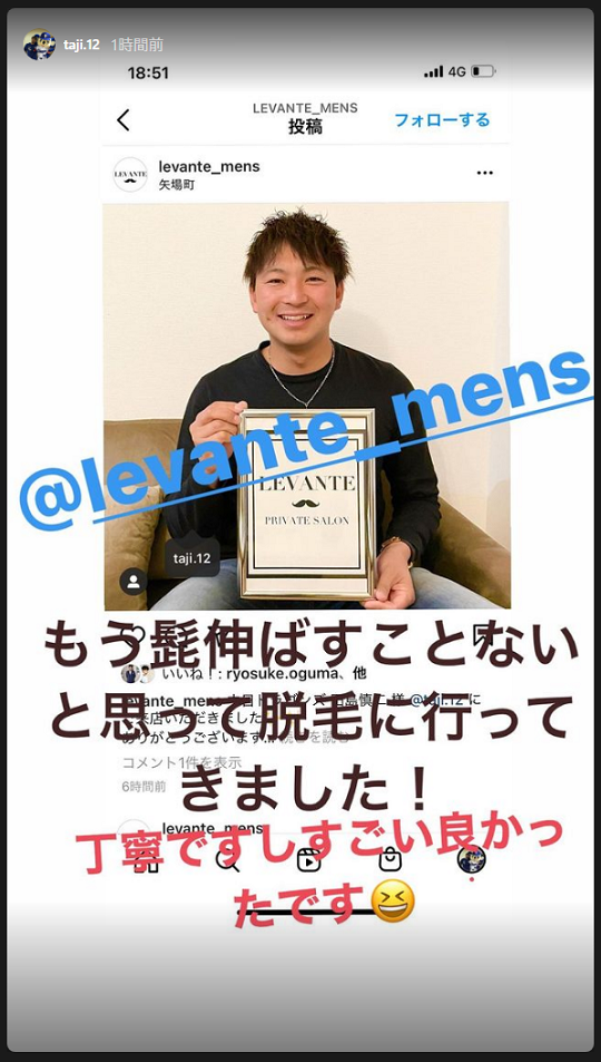 中日・田島慎二投手「もうこのヒゲ面になることはないだろう、、」　脱毛を行った結果…？