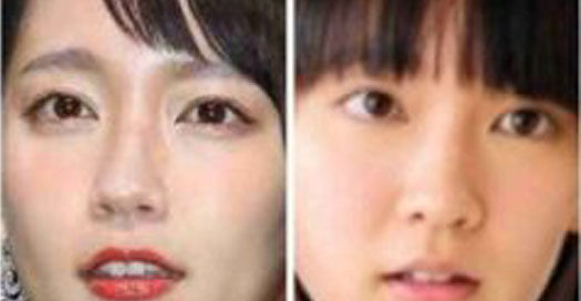 芸能人の鼻整形前と整形後を比較するスレ Docchinews