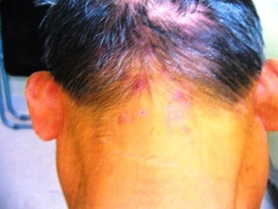 14年08月04日 ドクター康仁 こうじん のうんちく漢方塾