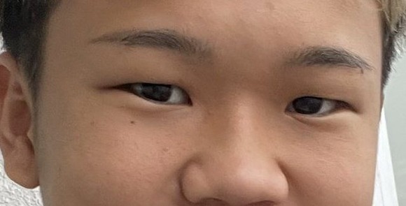 【悲報】ゆたぼん、事故の治療費をネットで乞食して整形代に使ってる疑惑浮上ｗｗｗｗｗｗｗｗｗｗ