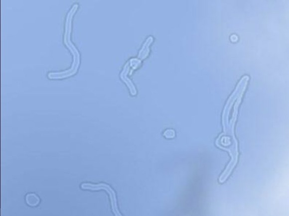 【画像】　目閉じたら"コレ"見えるのなんでなんｗｗｗｗｗｗ