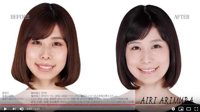 朗報 有村藍里 23 整形成功して妹の有村架純を超えてしまうwwywwwww なんjクエスト 朗報 有村藍里 23 整形成功して妹の有村架純を超えてしまうwwywwwww なんjクエスト