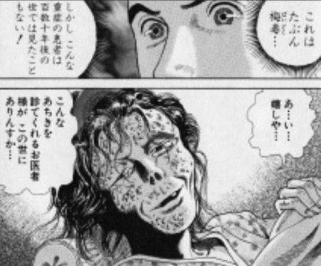 梅毒 剣心
