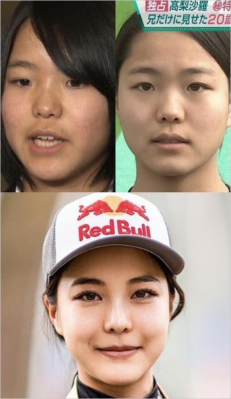 スキージャンプの高梨沙羅さん 別人になる なんjクエスト