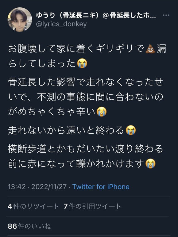 【悲惨】骨延長の人、骨延長の影響で走れず尊厳を失うｗｗｗｗｗｗ