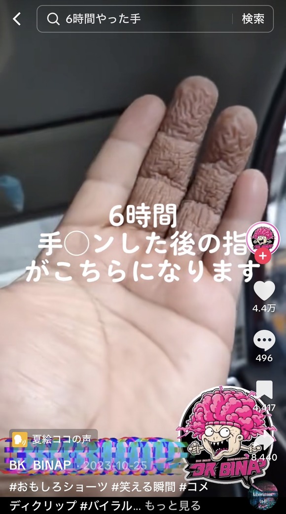 【画像】６時間いたした男の指がやば過ぎると話題にｗｗｗｗｗｗｗｗｗｗｗｗｗｗｗｗ